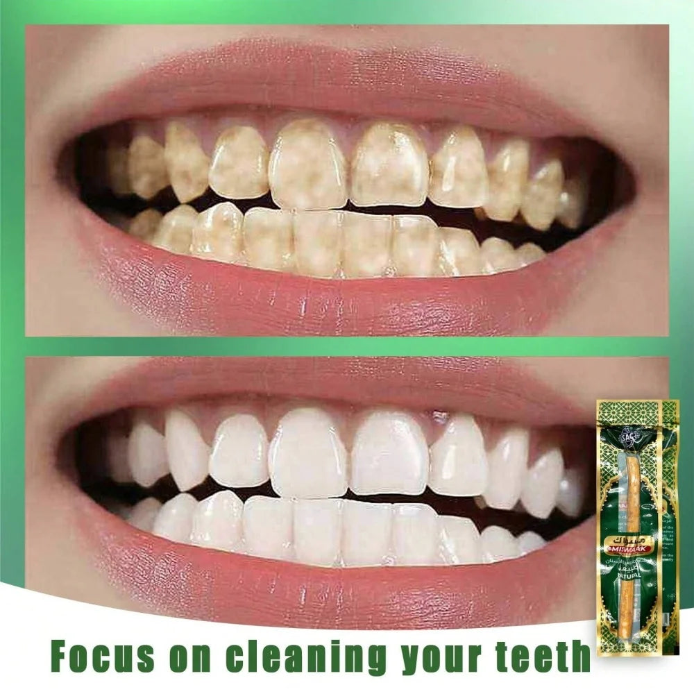 Natural Miswak Traditional Toothbrush Stick for Whiter Teeth, Healthy Gums, and Fresher Breath